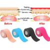 Kinesiology Tape Muscle Bandage Sports Cotton Elastic Adhesive Strain Injury Tape Knee Muscle Pain Relief Stickers (Random Colors) - Image 20