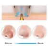 Electric Suction Blackhead Instrument Home Beauty Instrument Blackhead Pore Cleaning - Image 5